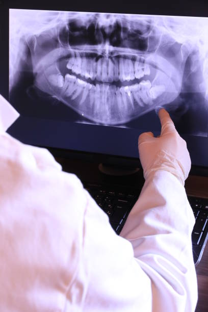 Best Emergency Root Canal Treatment in Saunders Lake, OR